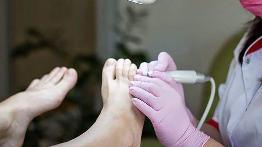 Viksman podo nail - Gallery Image 1